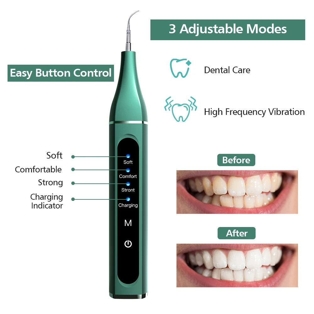 Electric Wireless Cu Ultrasunete Detartraj Dentar Albire Dinti Calcul Tartru Remover Instrumente Curat Dinte Pata Îngrijire Orală Imagine 4